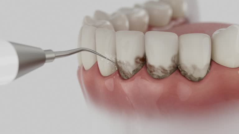 Reliable Dental contractor in Calhoun Falls, SC by Dentist Open Now